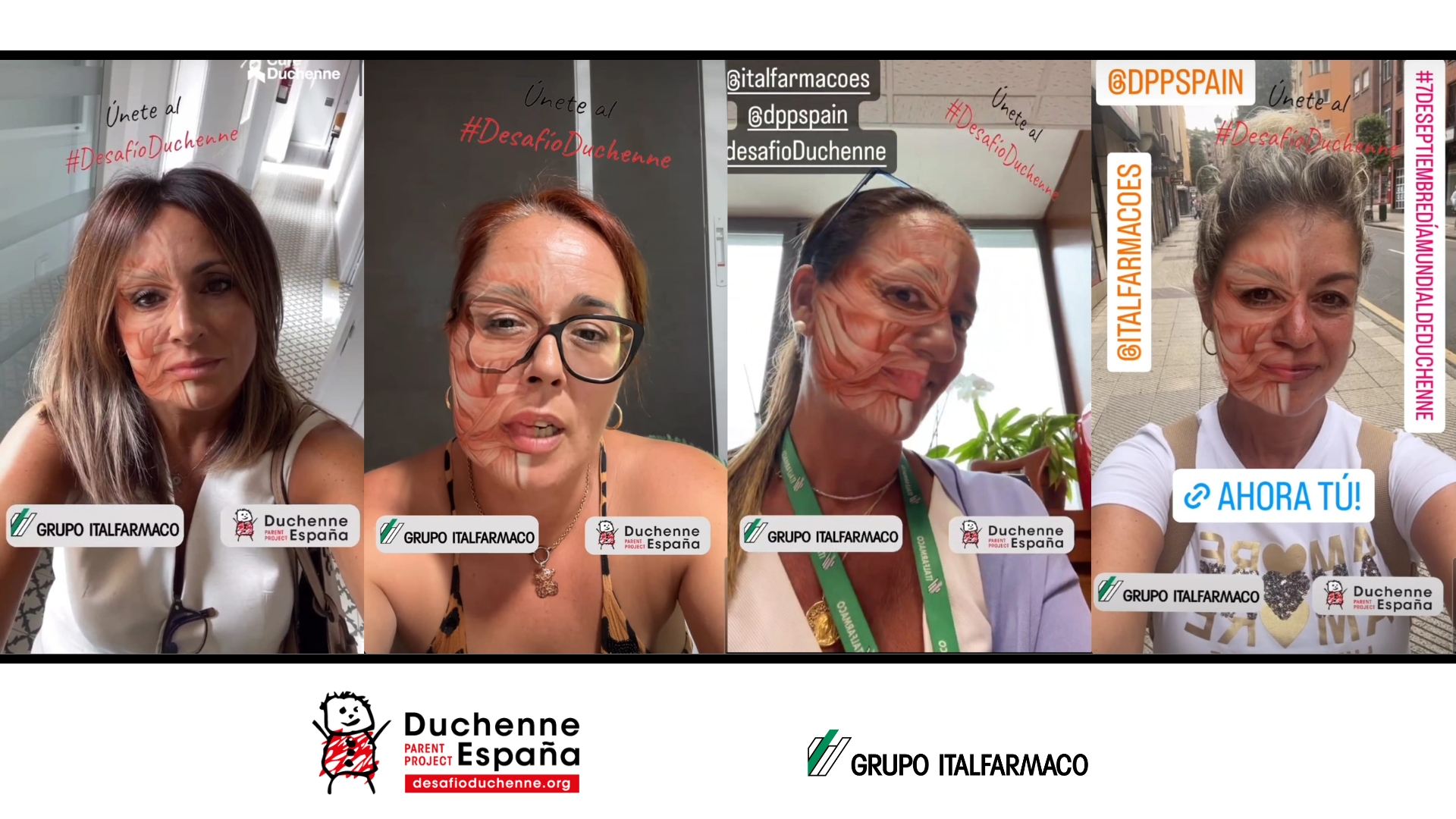 Fotos filtro Duchenne
